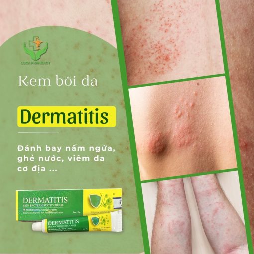 Kem Bôi Da Trị Nấm Ngứa Dermatitis Thụy Sỹ